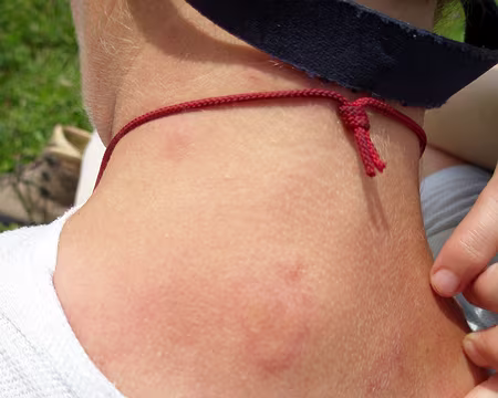 Tournette 009 l'encadrante est un peu piquée