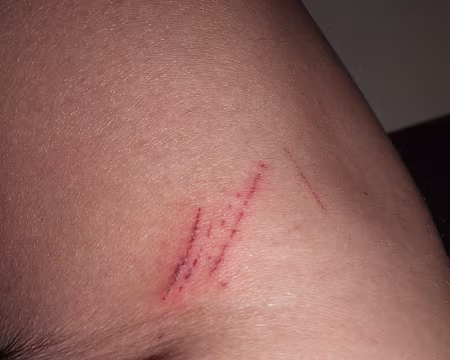 PXL024 Grimpette par une pente sauvage - bis.