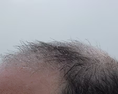 010 Gouttelettes sur l'animal.