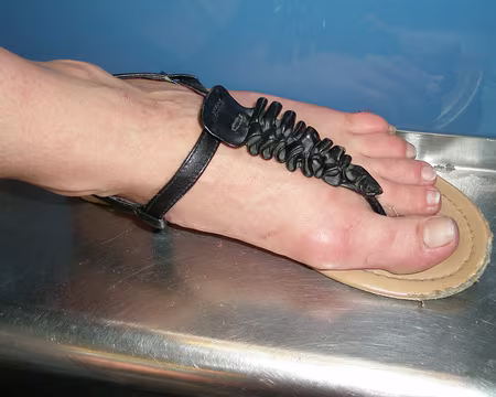 P7150016z1208 Un pied de sportive