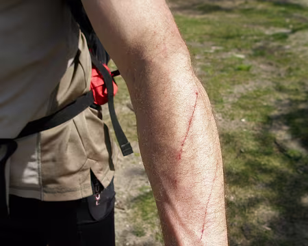 P4270030 Les marques du combat contre les ronces